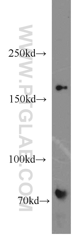 Western Blot (WB) analysis of mouse heart tissue using MBD5 Polyclonal antibody (15961-1-AP)