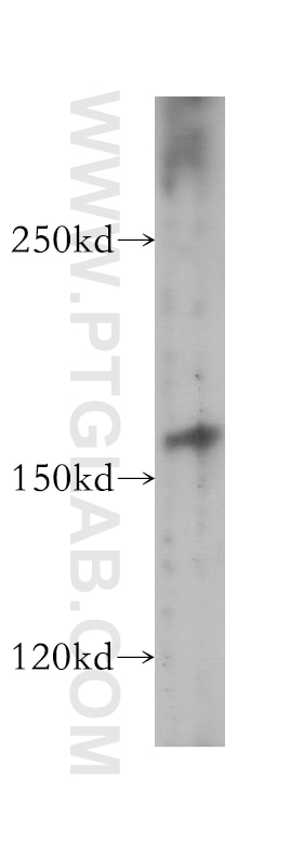 Western Blot (WB) analysis of human skeletal muscle tissue using MBD5 Polyclonal antibody (15961-1-AP)