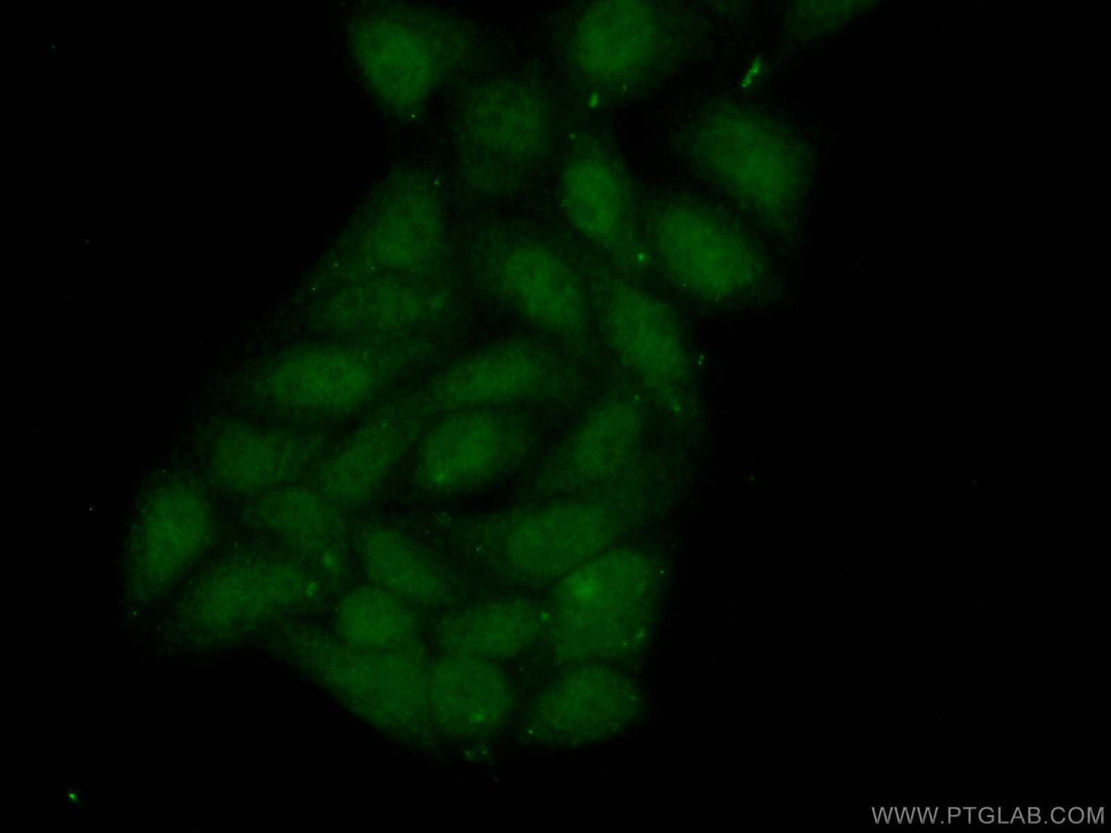 Immunofluorescence (IF) / fluorescent staining of HepG2 cells using MBIP Polyclonal antibody (10685-1-AP)