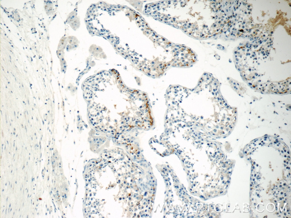 Immunohistochemistry (IHC) staining of human testis tissue using MBIP Polyclonal antibody (10685-1-AP)