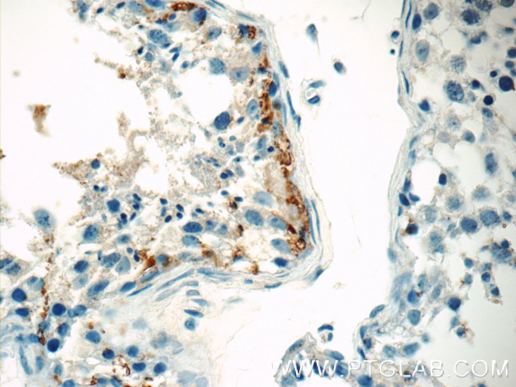 Immunohistochemistry (IHC) staining of human testis tissue using MBIP Polyclonal antibody (10685-1-AP)