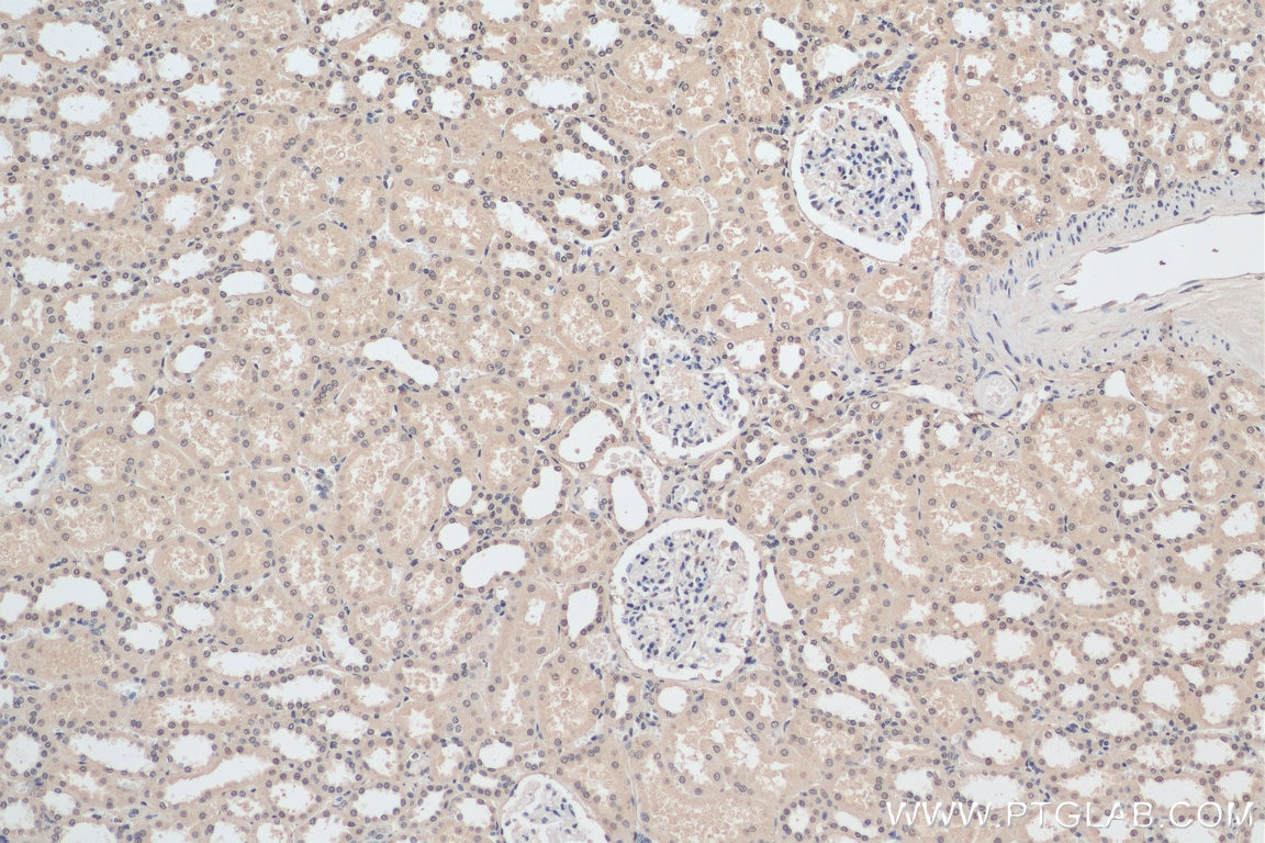 Immunohistochemistry (IHC) staining of human kidney tissue using MBIP Monoclonal antibody (66102-1-Ig)