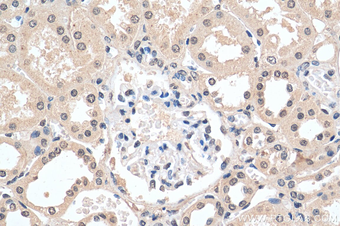 Immunohistochemistry (IHC) staining of human kidney tissue using MBIP Monoclonal antibody (66102-1-Ig)