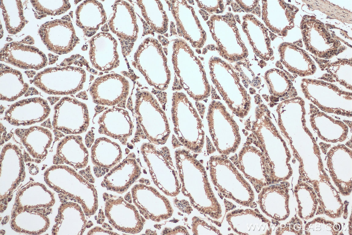 Immunohistochemistry (IHC) staining of mouse testis tissue using MBIP Monoclonal antibody (66102-1-Ig)