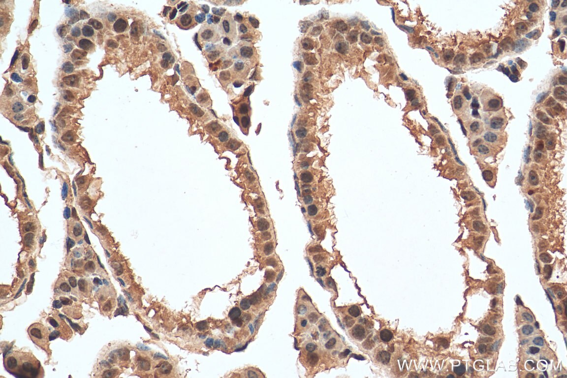 Immunohistochemistry (IHC) staining of mouse testis tissue using MBIP Monoclonal antibody (66102-1-Ig)