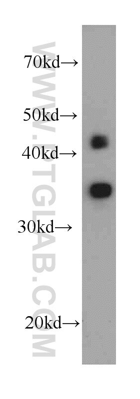 Western Blot (WB) analysis of HepG2 cells using MBIP Monoclonal antibody (66102-1-Ig)
