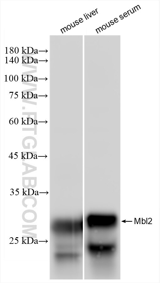 Western Blot (WB) analysis of various lysates using MBL Recombinant antibody (85835-4-RR)