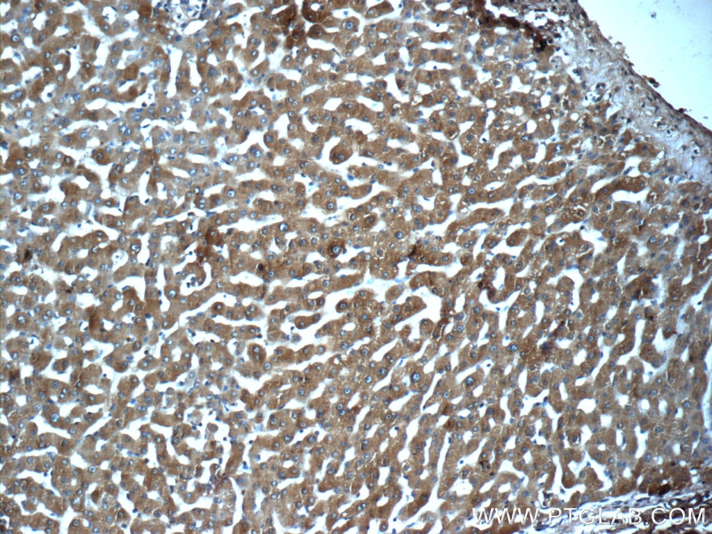 IHC staining of human liver using 24207-1-AP