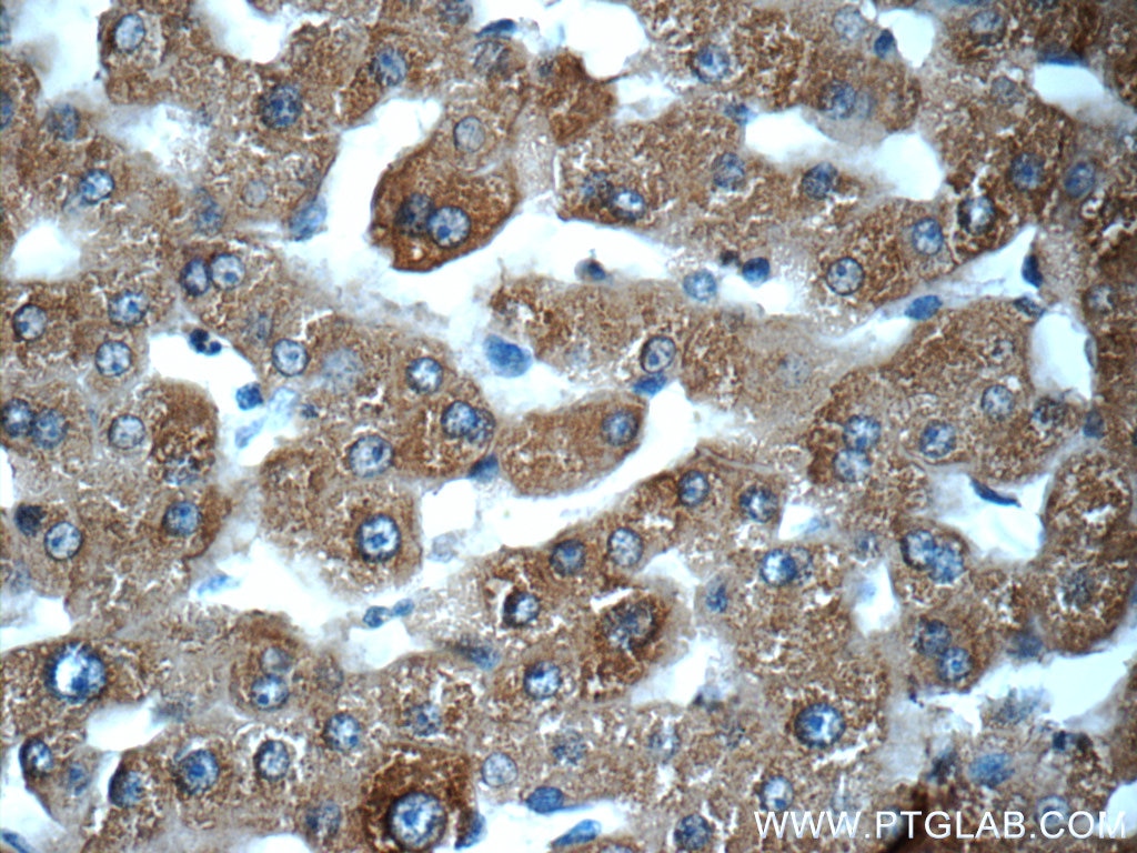 IHC staining of human liver using 24207-1-AP