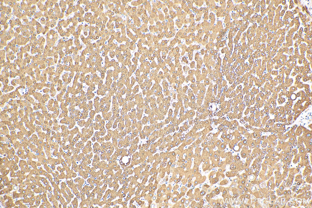 Immunohistochemistry (IHC) staining of human liver tissue using MBL2 Polyclonal antibody (24207-1-AP)