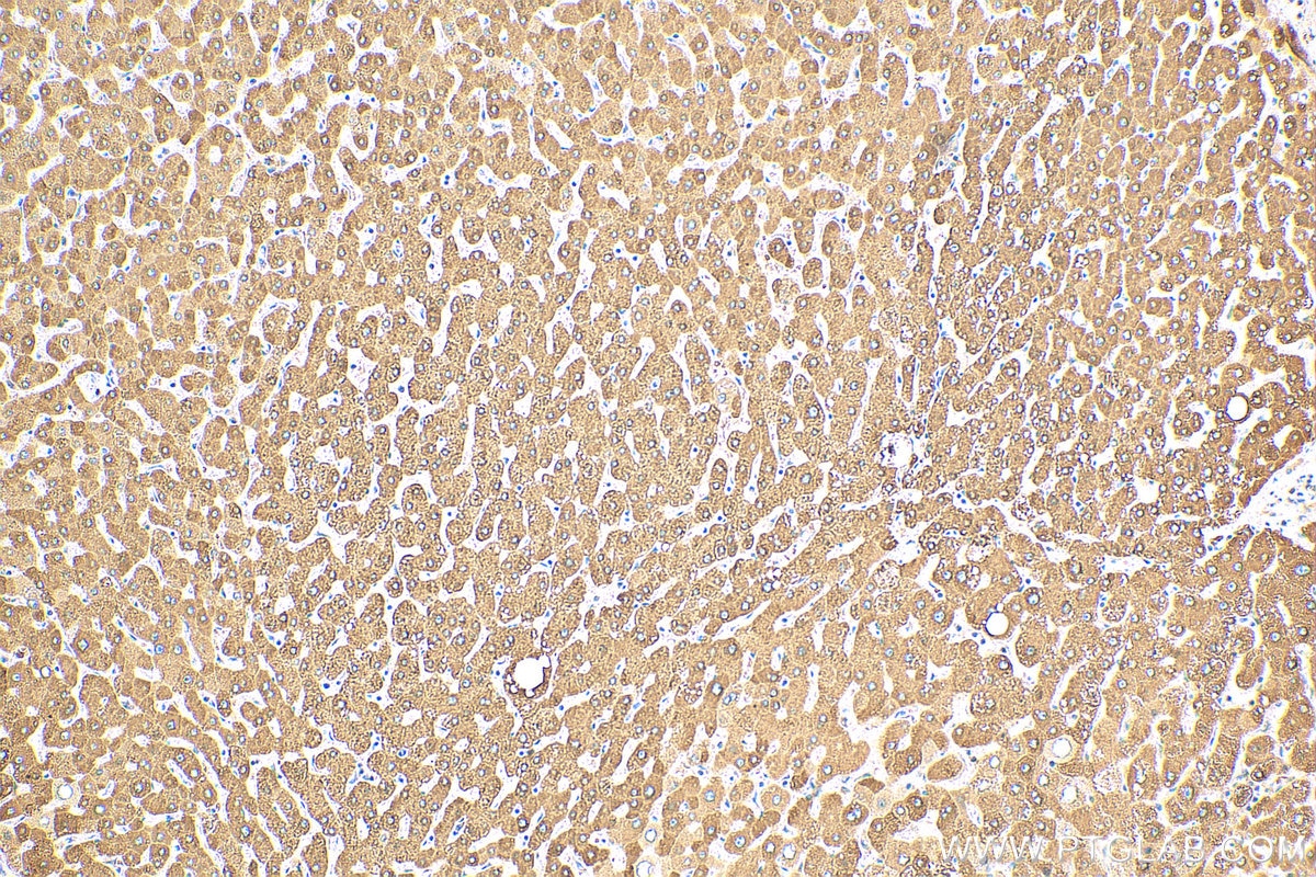 Immunohistochemistry (IHC) staining of human liver tissue using MBL Polyclonal antibody (24207-1-AP)