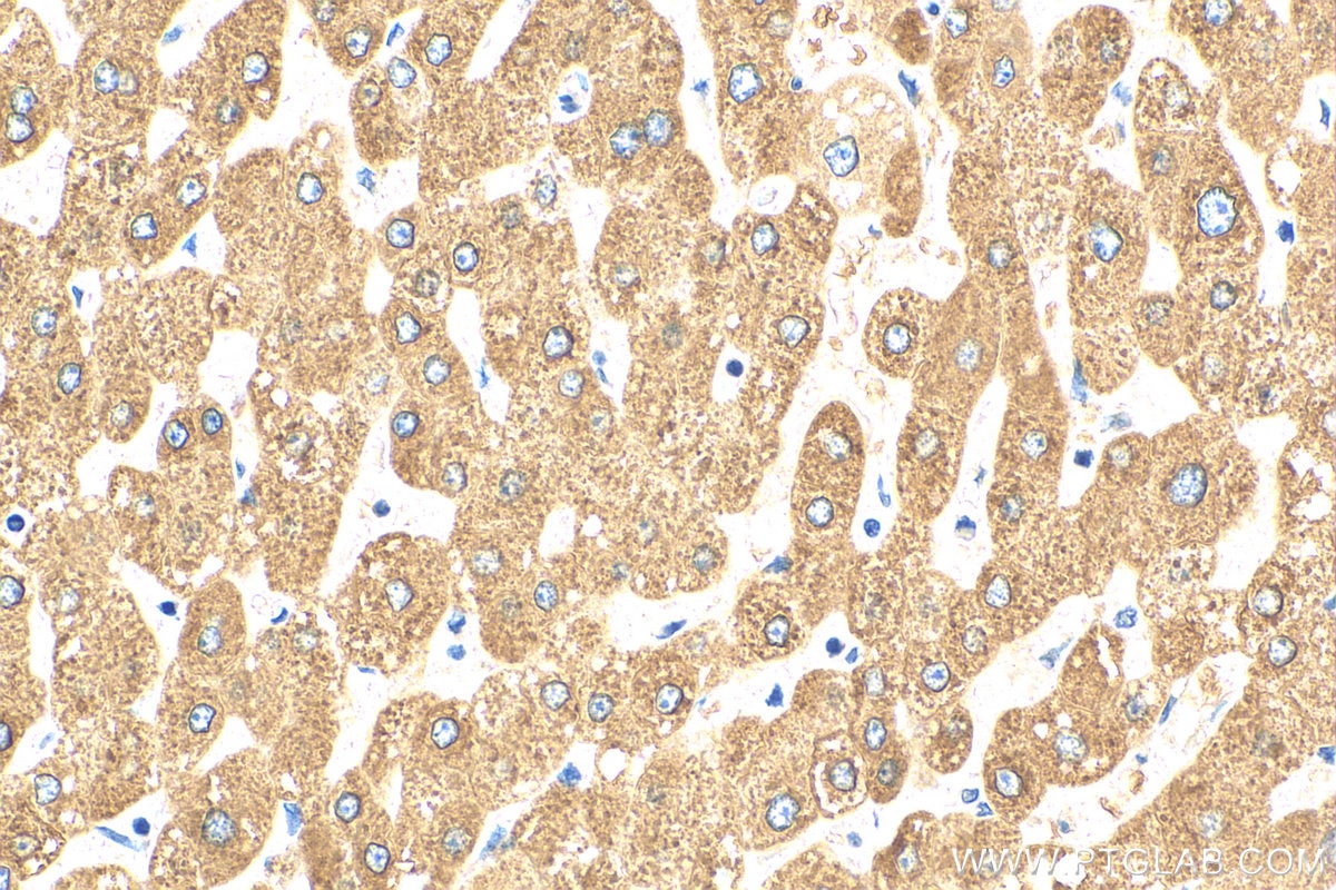 Immunohistochemistry (IHC) staining of human liver tissue using MBL2 Polyclonal antibody (24207-1-AP)