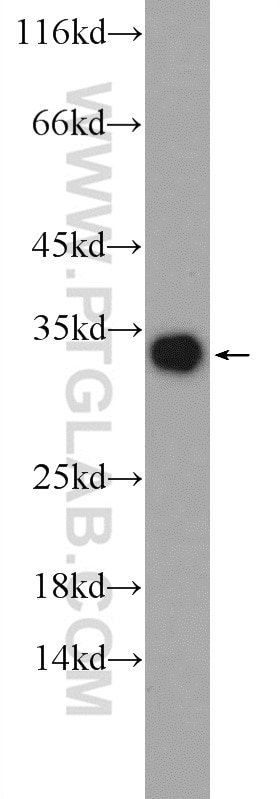 Western Blot (WB) analysis of human plasma using MBL2 Polyclonal antibody (24207-1-AP)