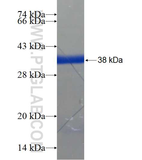 MBL2 fusion protein Ag21508 SDS-PAGE