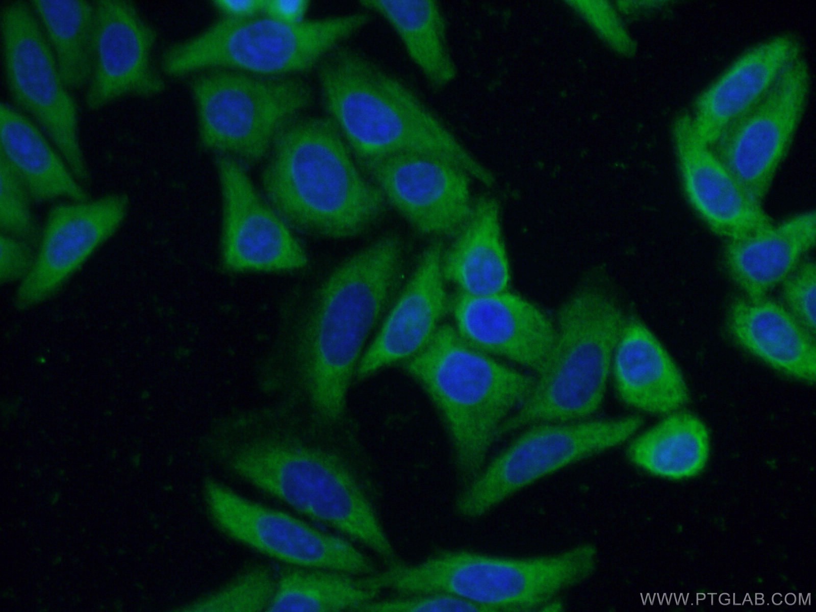 Immunofluorescence (IF) / fluorescent staining of HepG2 cells using MBNL1 Monoclonal antibody (66837-1-Ig)