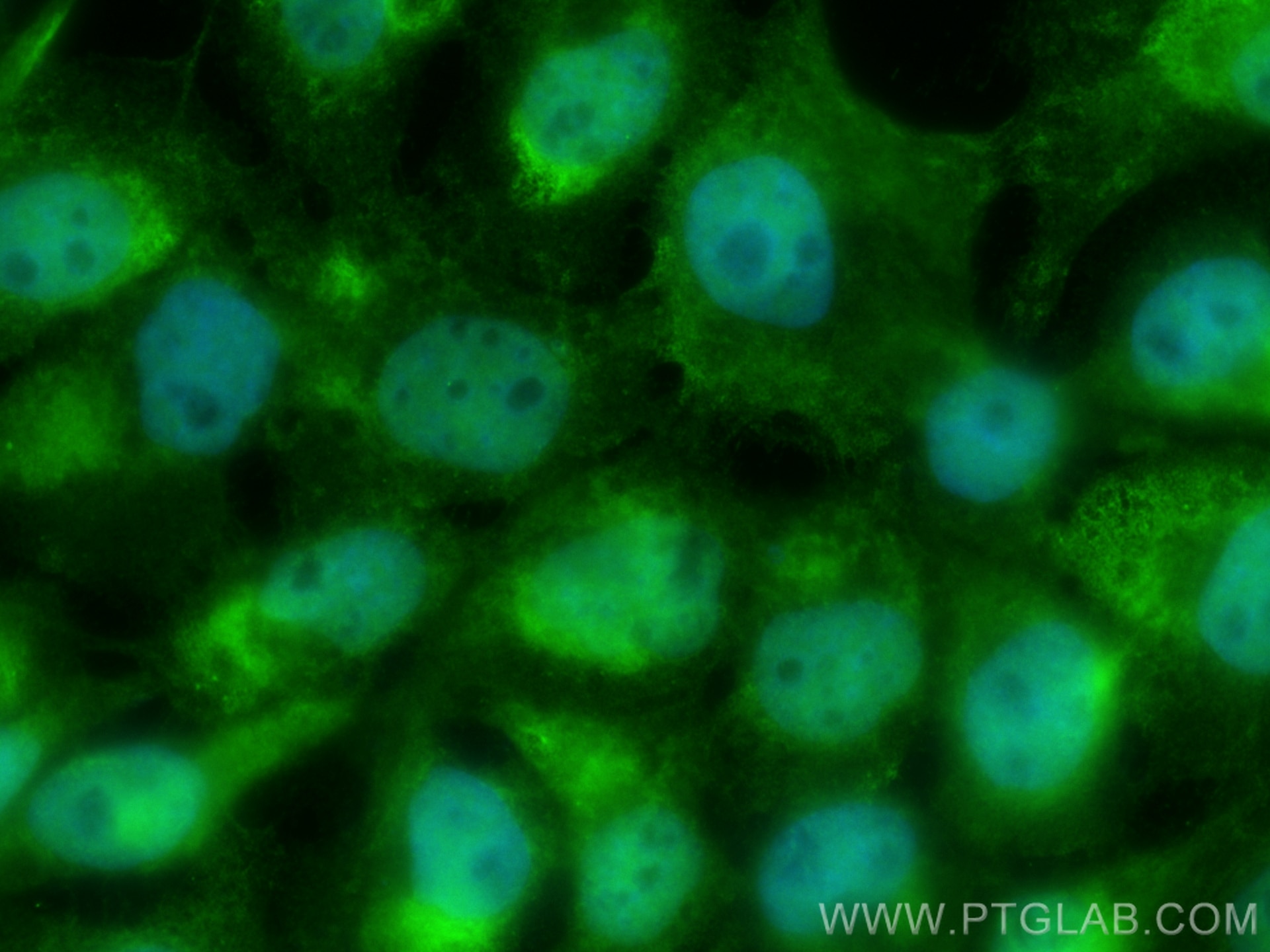 Immunofluorescence (IF) / fluorescent staining of A431 cells using CoraLite® Plus 488-conjugated MBNL1 Monoclonal ant (CL488-66837)