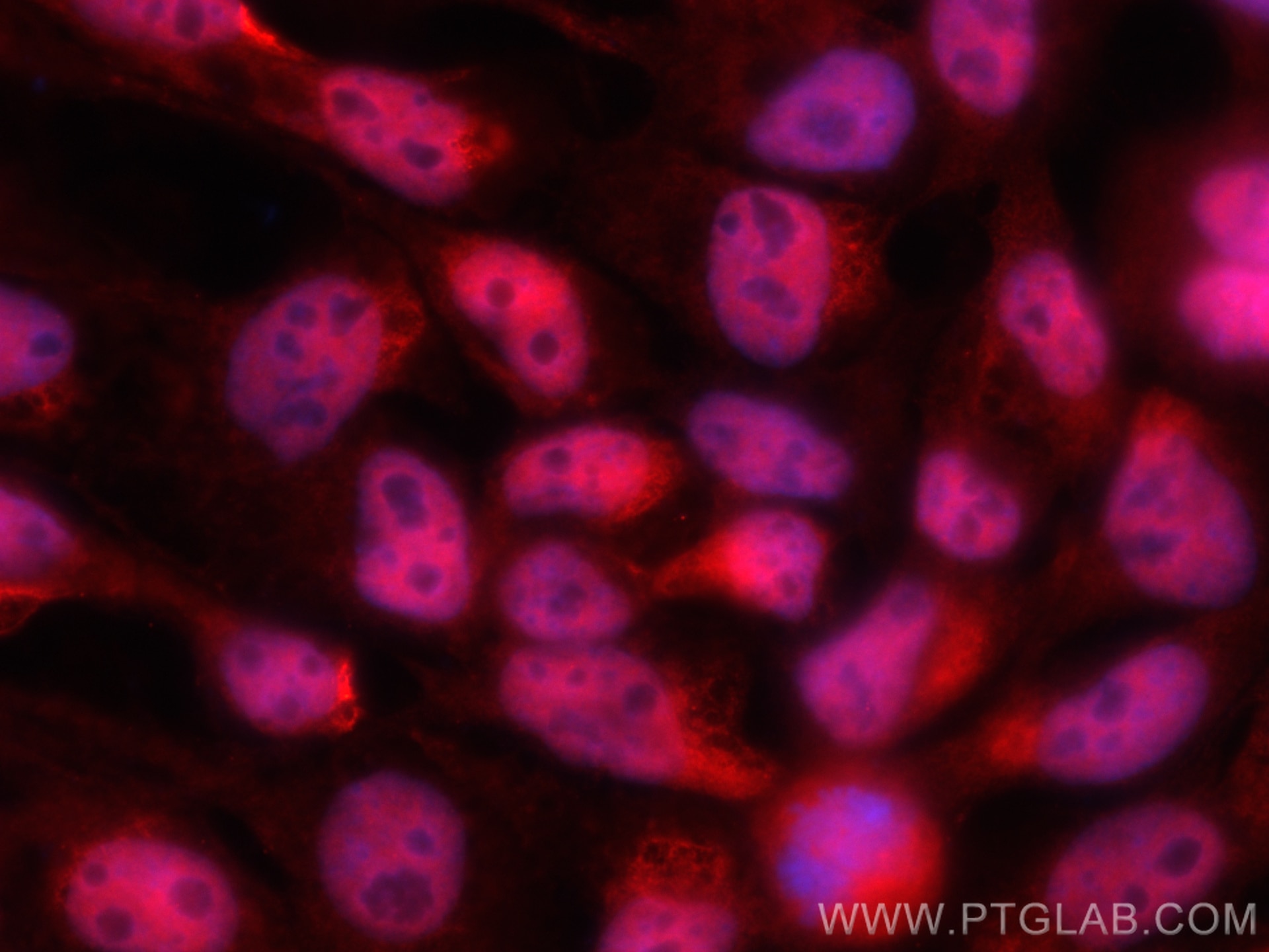 Immunofluorescence (IF) / fluorescent staining of A431 cells using CoraLite®594-conjugated MBNL1 Monoclonal antibody (CL594-66837)