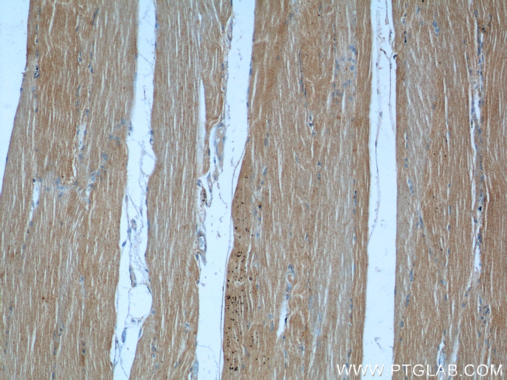 Immunohistochemistry (IHC) staining of human skeletal muscle tissue using MBNL3 Polyclonal antibody (24610-1-AP)