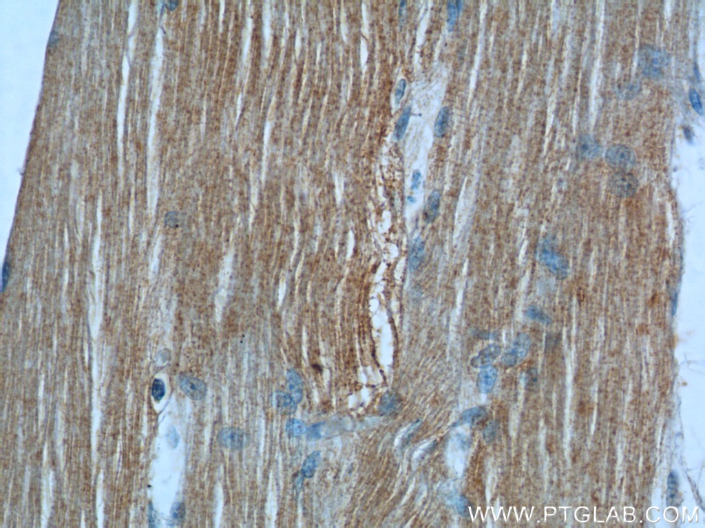 Immunohistochemistry (IHC) staining of human skeletal muscle tissue using MBNL3 Polyclonal antibody (24610-1-AP)