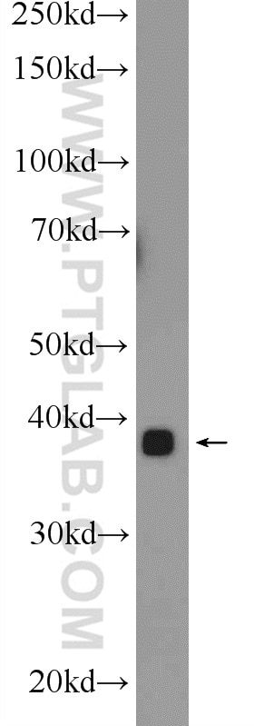 Western Blot (WB) analysis of mouse skeletal muscle tissue using MBNL3 Polyclonal antibody (24610-1-AP)