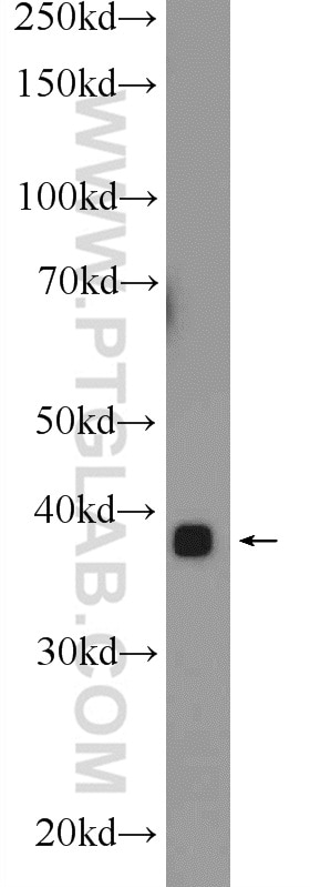 WB analysis of mouse skeletal muscle using 24610-1-AP