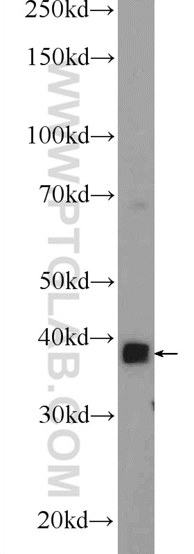 Western Blot (WB) analysis of mouse skeletal muscle tissue using MBNL3 Polyclonal antibody (24610-1-AP)