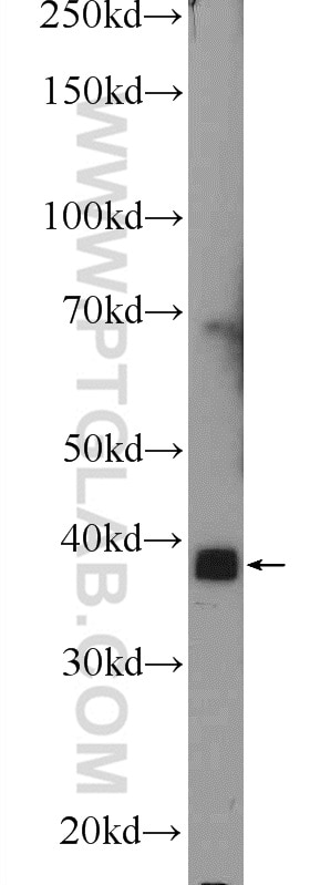 Western Blot (WB) analysis of mouse skeletal muscle tissue using MBNL3 Polyclonal antibody (24610-1-AP)