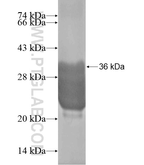MBNL3 fusion protein Ag20113 SDS-PAGE