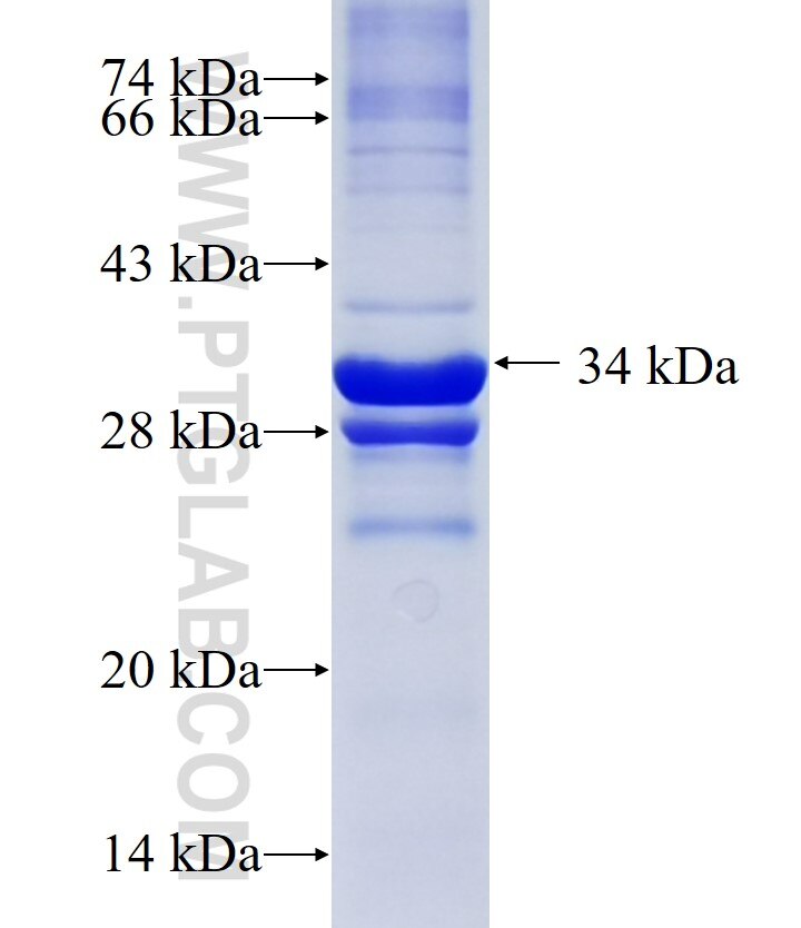 MBOAT1 fusion protein Ag22470 SDS-PAGE
