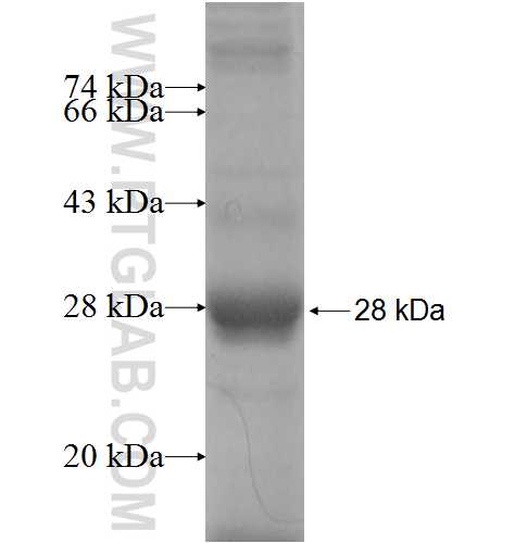 MBOAT2 fusion protein Ag9550 SDS-PAGE
