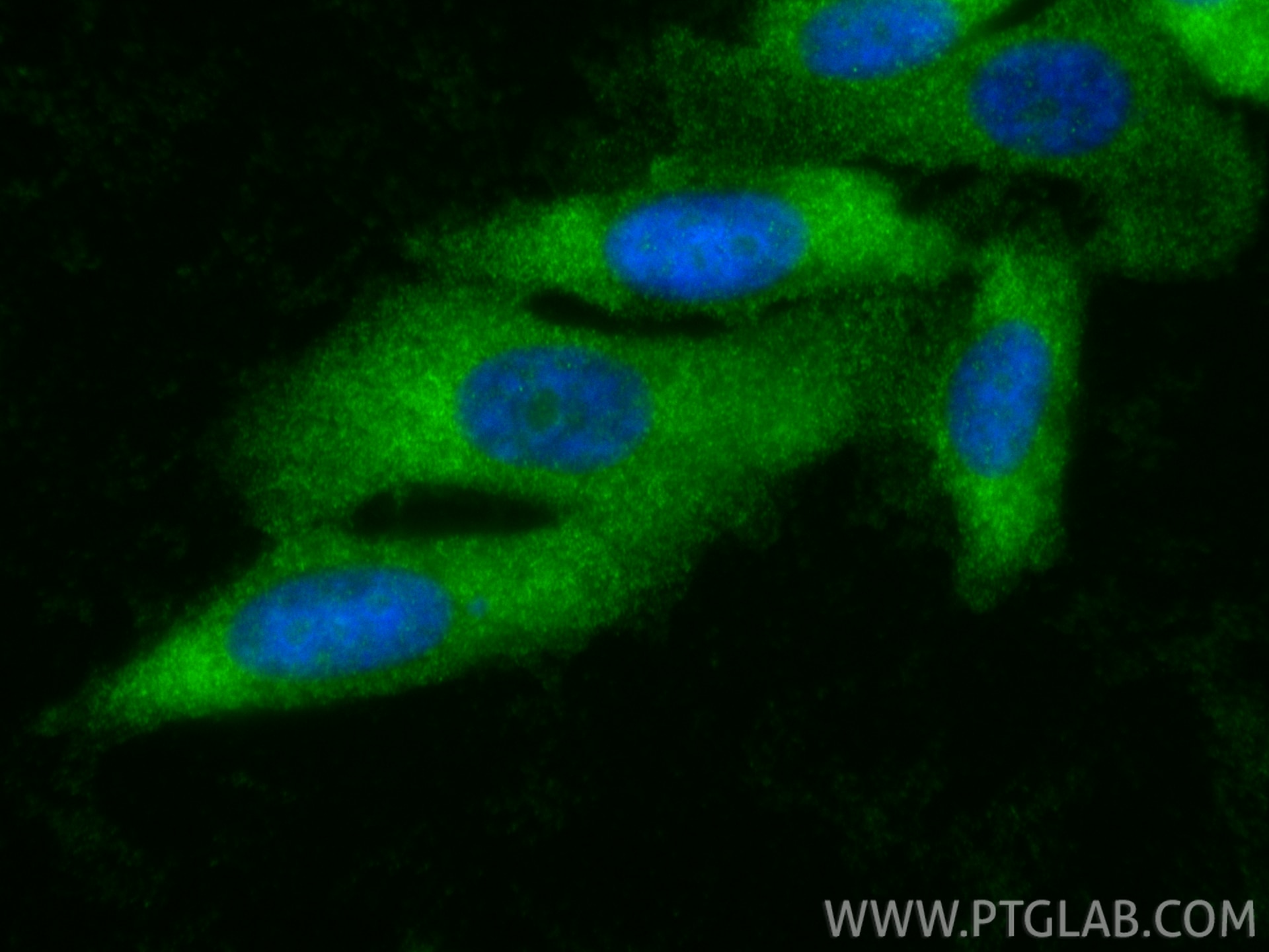 Immunofluorescence (IF) / fluorescent staining of PC-3 cells using MBOAT7 Polyclonal antibody (26646-1-AP)