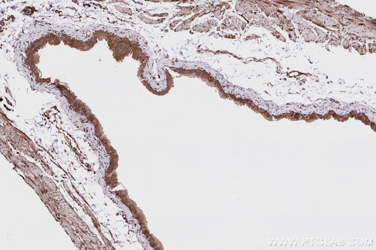 IHC staining of mouse bladder using 83546-3-RR Immunohistochemistry (IHC) staining of mouse bladder tissue using MBOAT7 Recombinant monoclonal antibody (83546-3-RR)