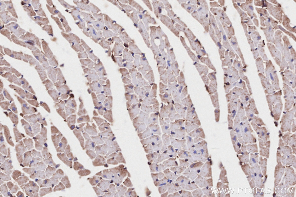 IHC staining of mouse heart using 83546-3-RR Immunohistochemistry (IHC) staining of mouse heart tissue using MBOAT7 Recombinant monoclonal antibody (83546-3-RR)