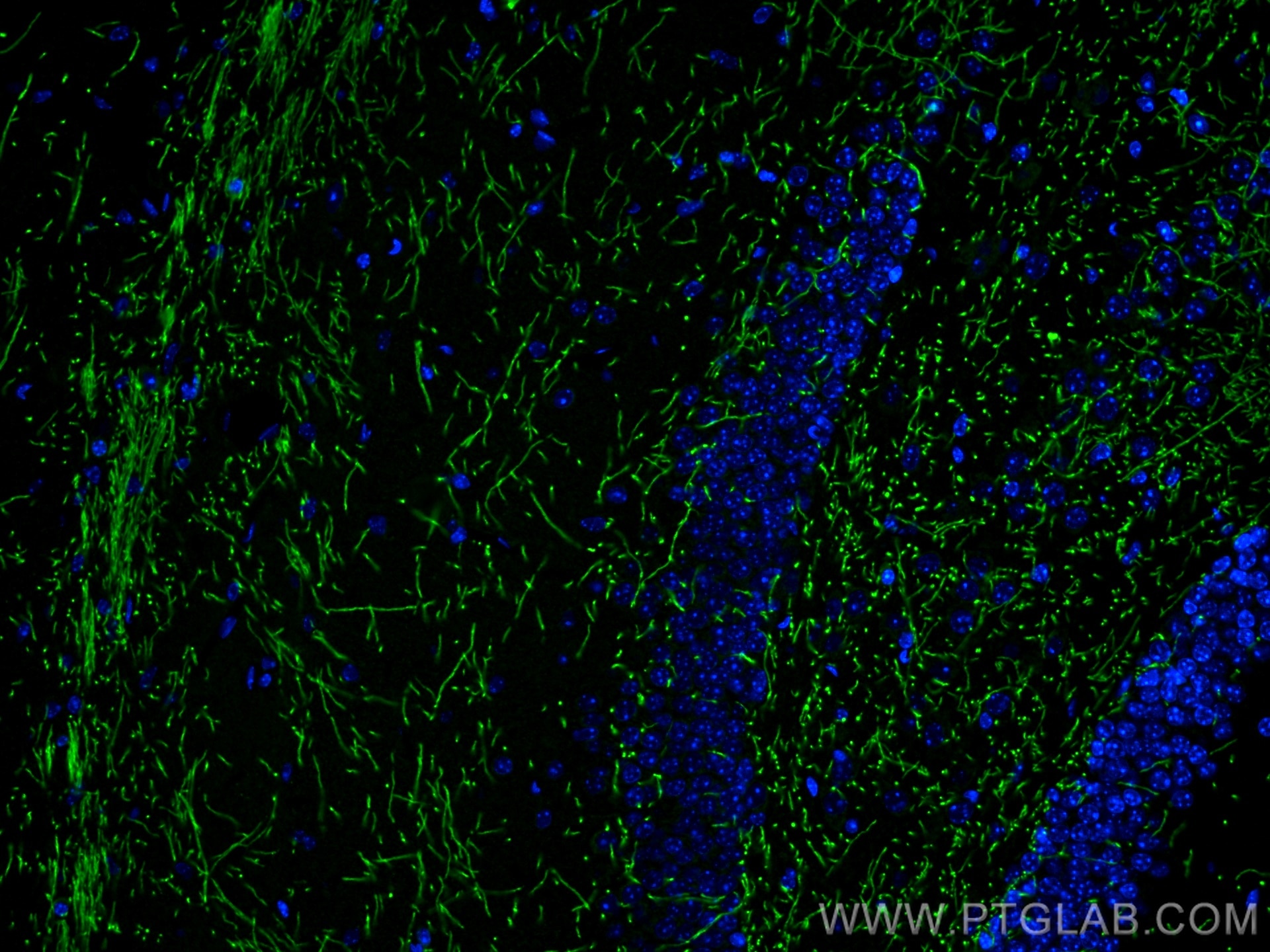 Immunofluorescence (IF) / fluorescent staining of mouse brain tissue using Myelin basic protein Polyclonal antibody (10458-1-AP)