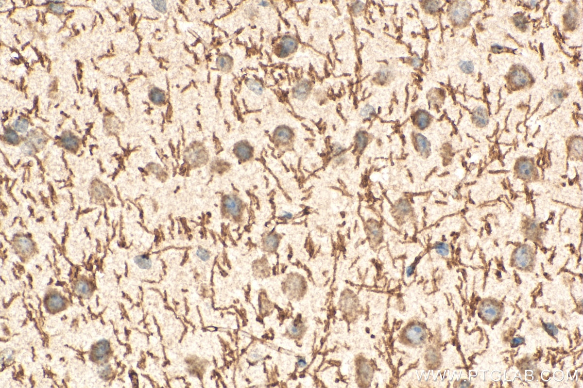 Immunohistochemistry (IHC) staining of mouse brain tissue using Myelin basic protein Polyclonal antibody (10458-1-AP)