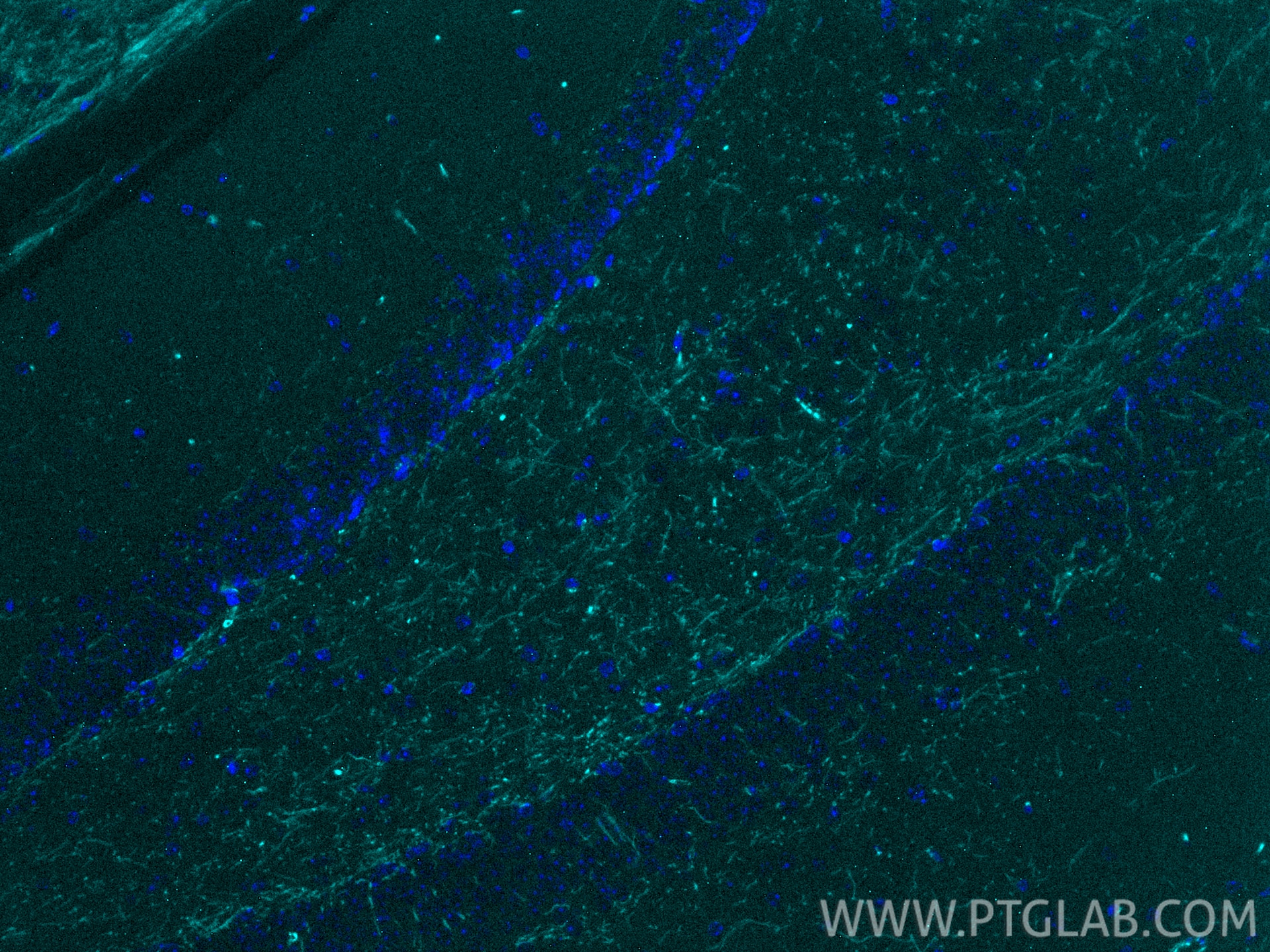 IF Staining of mouse brain using CL750-10458 Immunofluorescence (IF) / fluorescent staining of mouse brain tissue using CoraLite® Plus 750-conjugated MBP Polyclonal antib (CL750-10458)