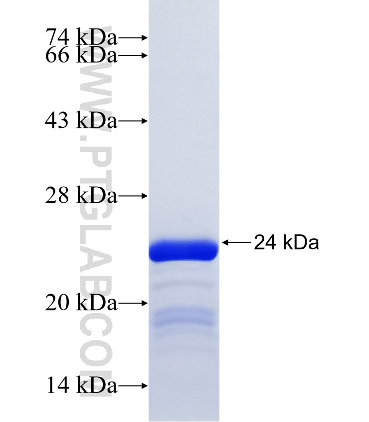 MBP fusion protein Ag24433 SDS-PAGE