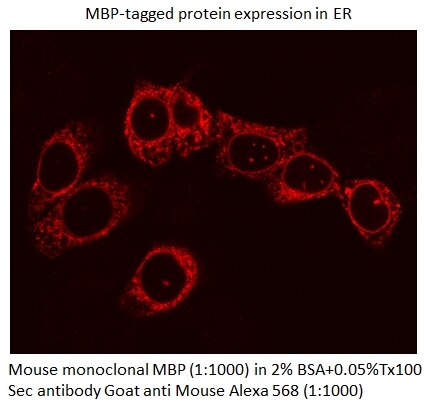 Immunofluorescence (IF) / fluorescent staining of Transfected cells using MBP tag Monoclonal antibody (66003-1-Ig)