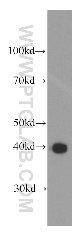 WB analysis of Recombinant protein using 66003-1-Ig