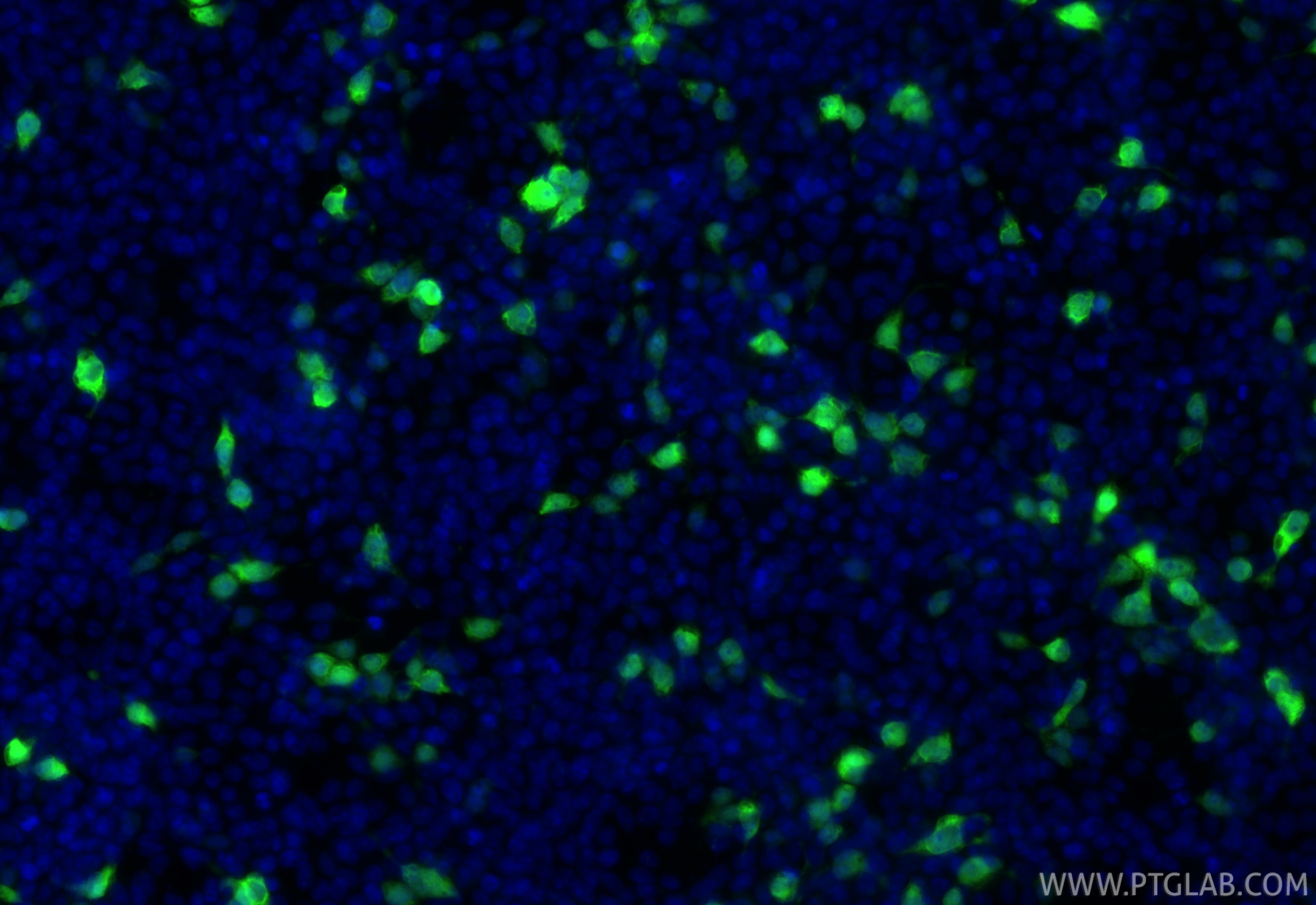 Immunofluorescent analysis of (-20°C Ethanol) fixed Transfected HEK-293 cells using CoraLite® Plus 488 MBP tag antibody (CL488-66003, Clone: 4C6H4 ) at dilution of 1:200. Immunofluorescence (IF) / fluorescent staining of Transfected HEK-293 cells using CoraLite® Plus 488-conjugated MBP tag Monoclonal a (CL488-66003)
