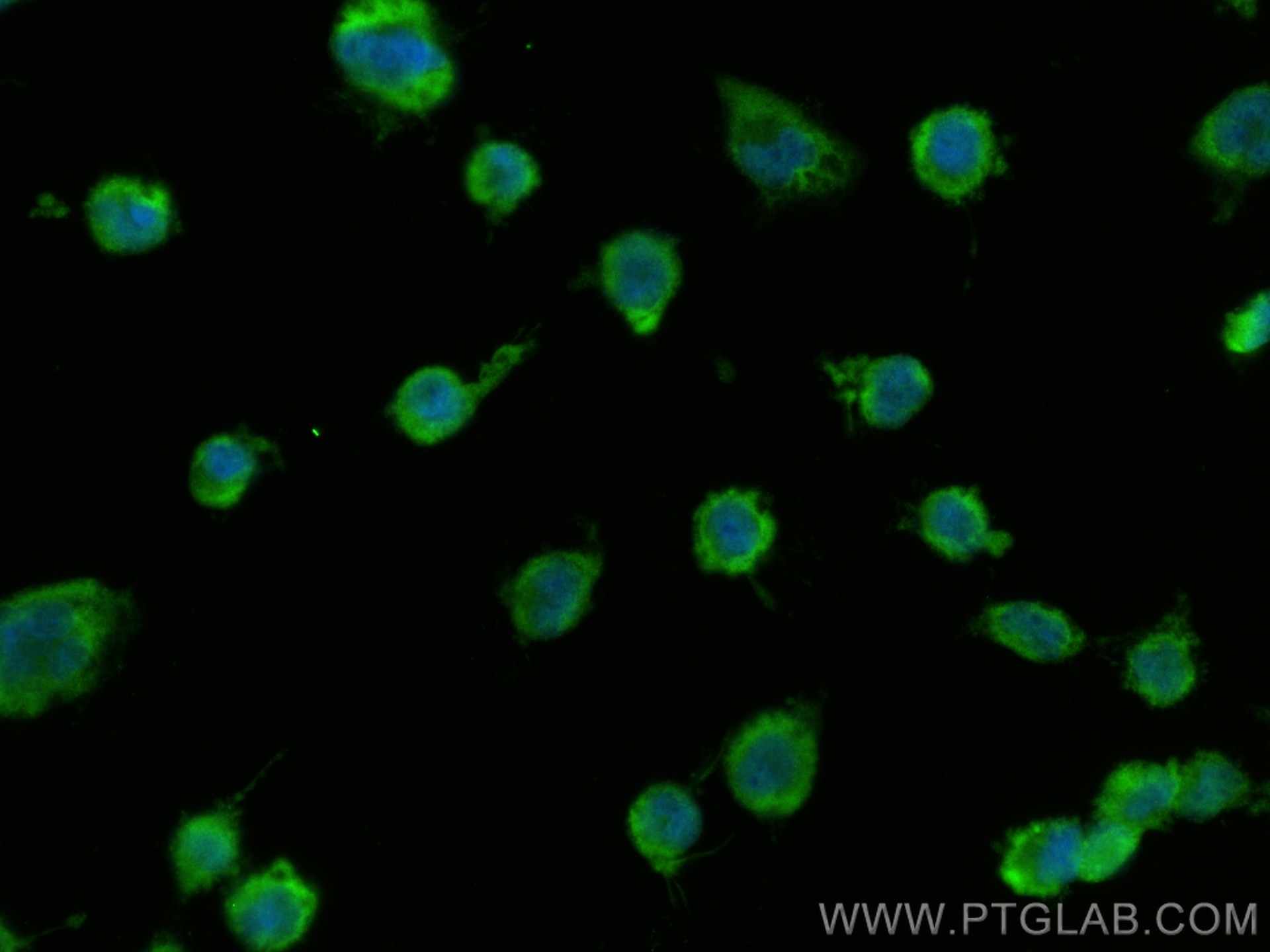 Immunofluorescence (IF) / fluorescent staining of U-251 cells using MBTD1 Polyclonal antibody (26098-1-AP)
