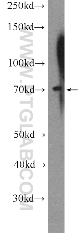 Western Blot (WB) analysis of K-562 cells using MBTD1 Polyclonal antibody (26098-1-AP)