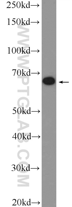 Western Blot (WB) analysis of Jurkat cells using MBTD1 Polyclonal antibody (26098-1-AP)