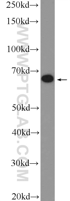 WB analysis of Jurkat using 26098-1-AP