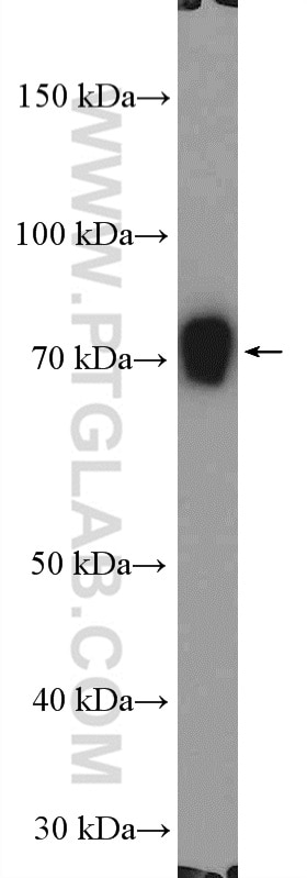 Western Blot (WB) analysis of mouse spleen tissue using MBTD1 Polyclonal antibody (26098-1-AP)