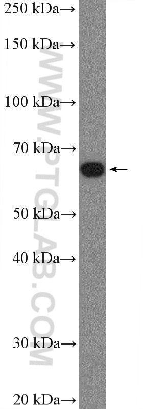 Western Blot (WB) analysis of HL-60 cells using MBTD1 Polyclonal antibody (26098-1-AP)