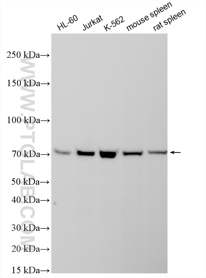 Western Blot (WB) analysis of various lysates using MBTD1 Polyclonal antibody (26098-1-AP)