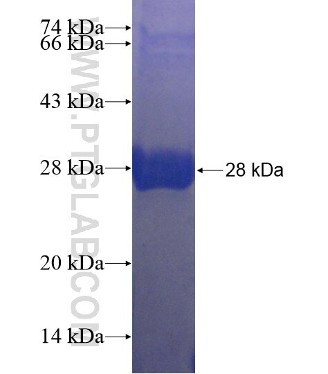 MBTD1 fusion protein Ag22059 SDS-PAGE