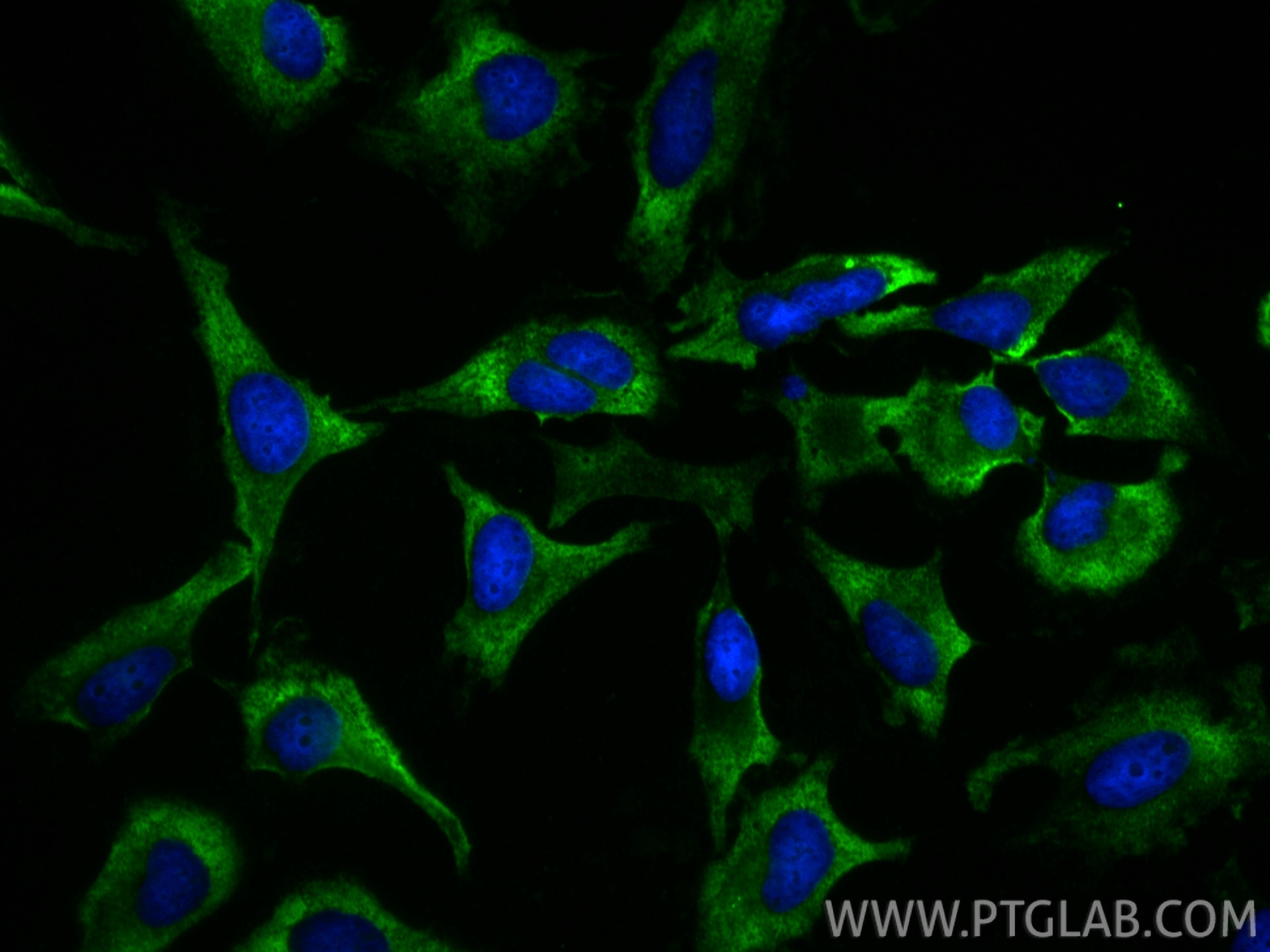 Immunofluorescence (IF) / fluorescent staining of HeLa cells using MC1R Polyclonal antibody (26471-1-AP)