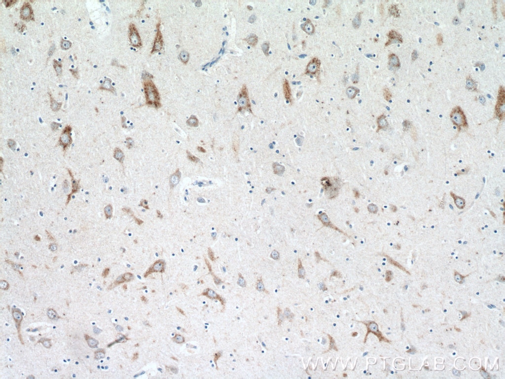 Immunohistochemistry (IHC) staining of human brain tissue using MC1R Polyclonal antibody (26471-1-AP)